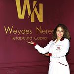 Weydes Neres|Terapeuta Capilar