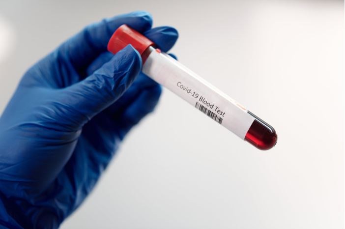 Coronavirus: antibody tests for everyone &#8216;soon&#8217; available via GPs