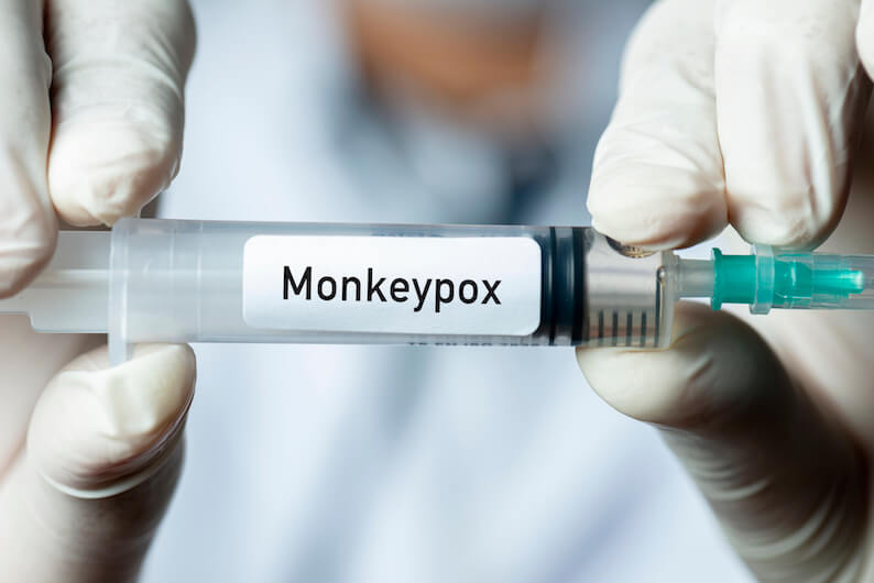 What is Monkeypox, and Should I Be Worried?