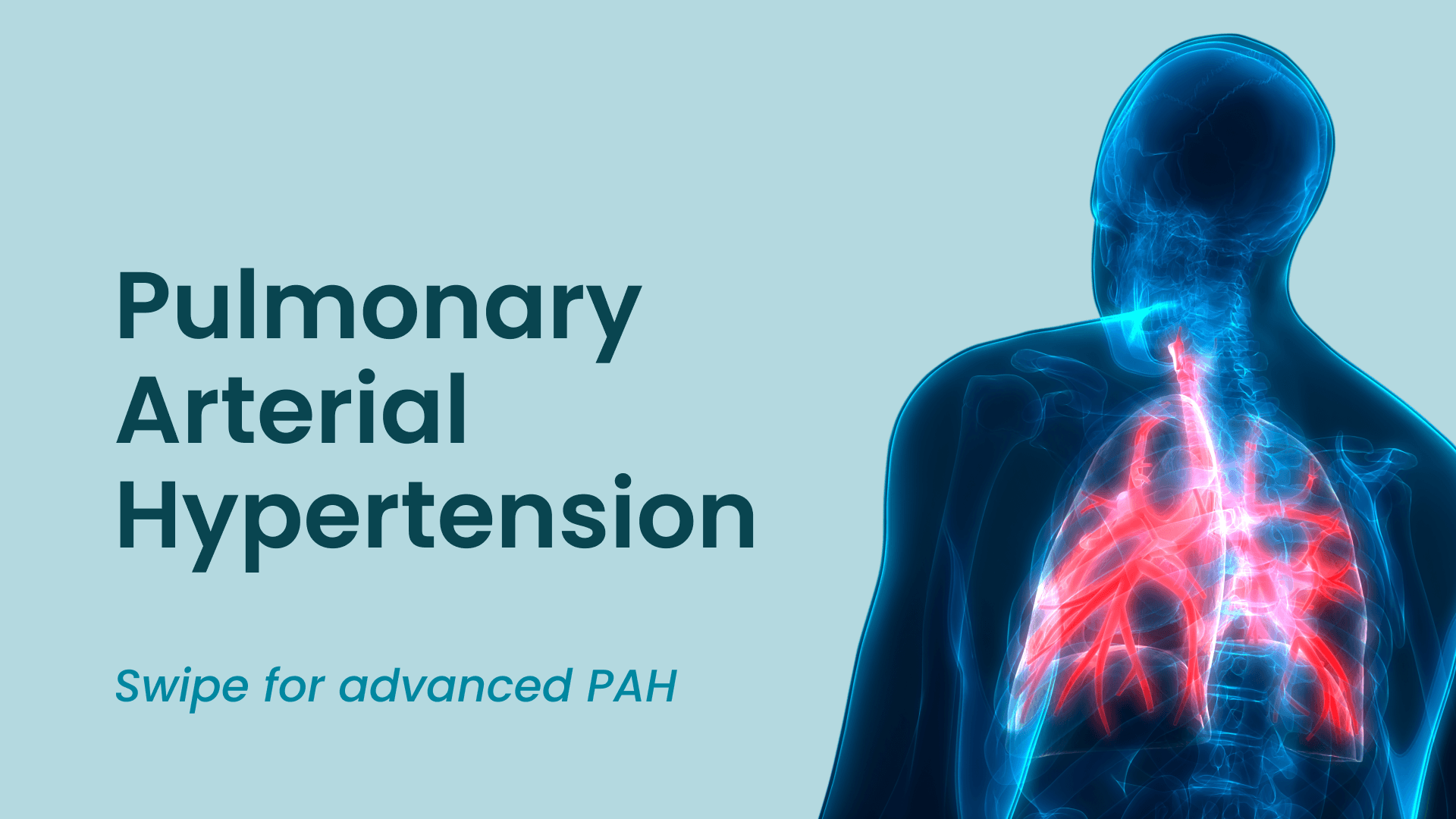 PAH resource center: symptoms and diagnosis