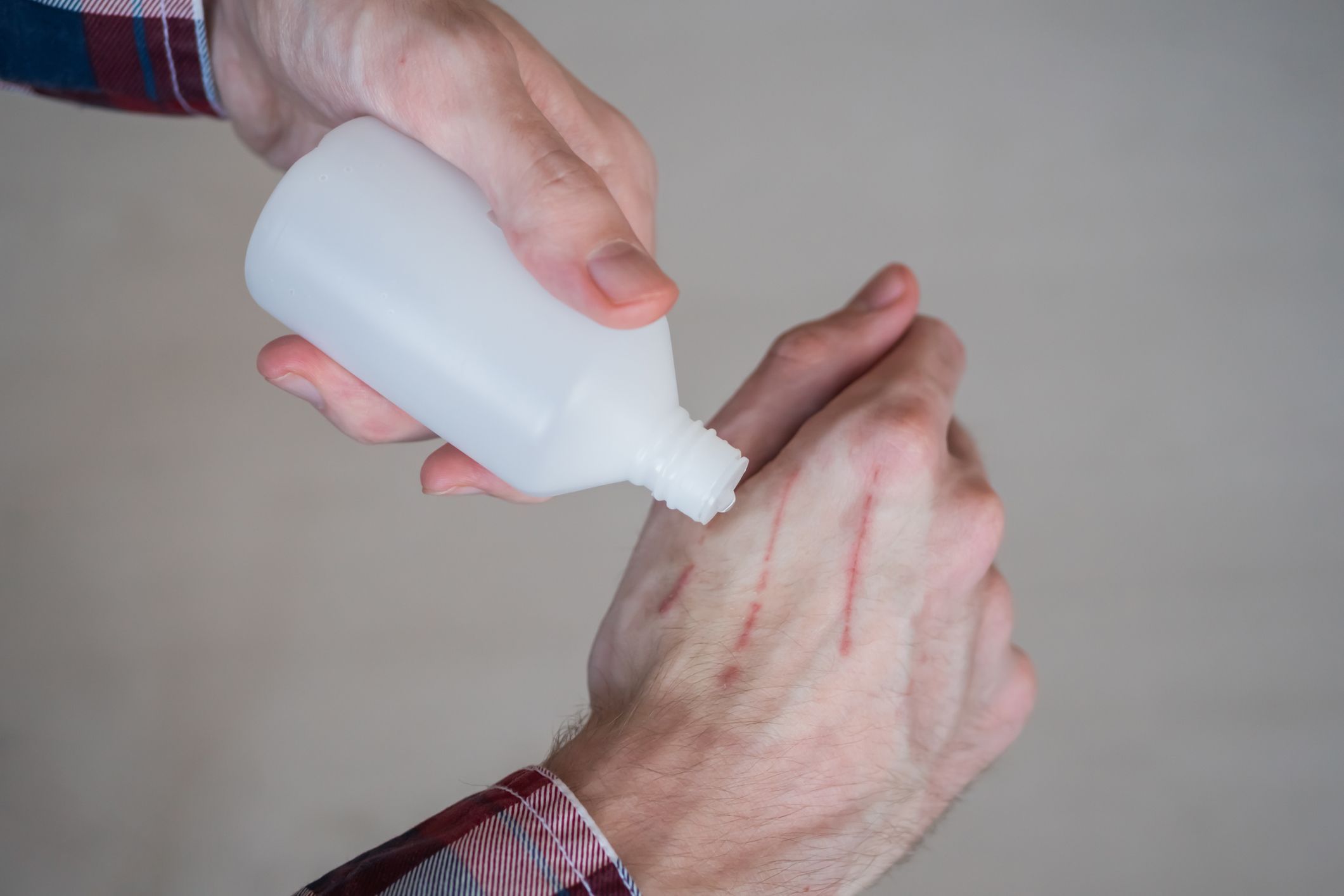 Mistake #2: Clean cuts with hydrogen peroxide