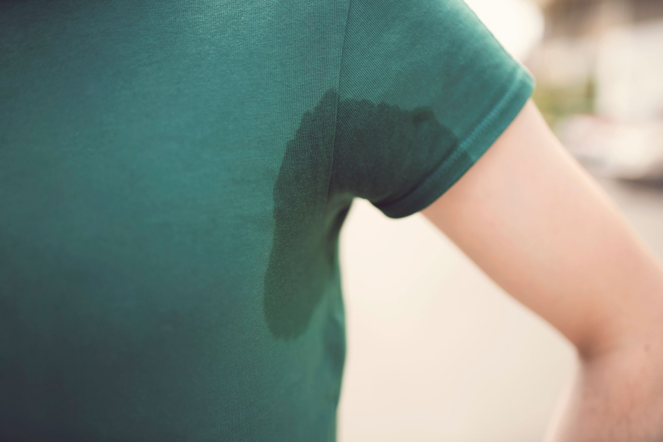 Excess Sweat