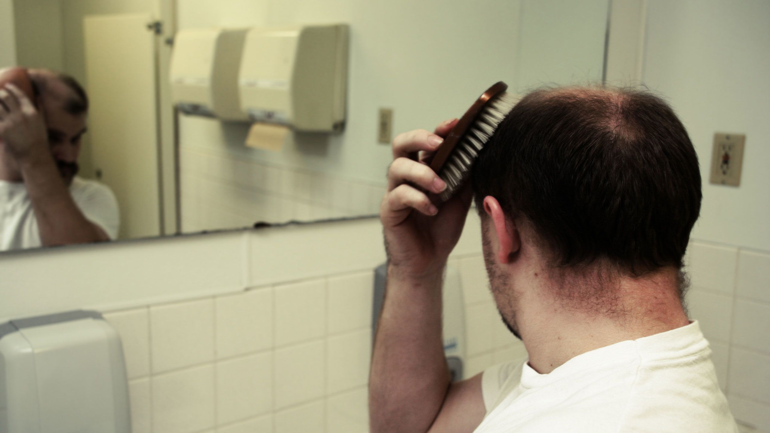 What can I do about my hair loss?