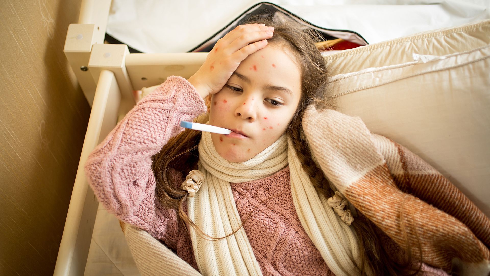 Is Shingles the same as Chickenpox?