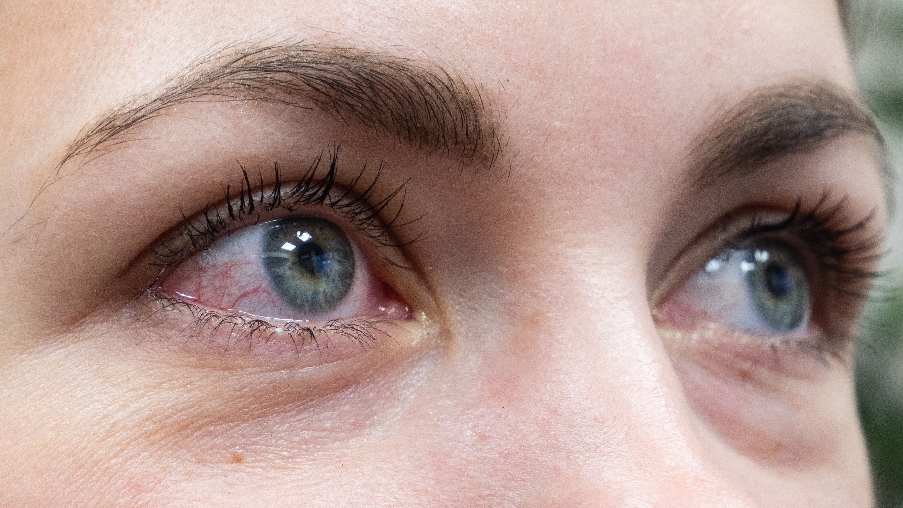 Red eyes