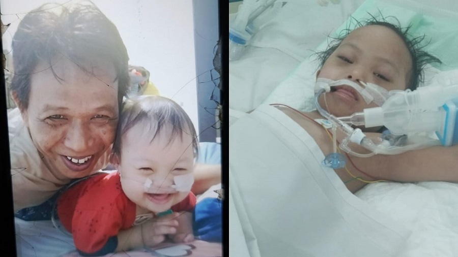 Kondisi Kritis. Bantu Kalief, Balita Yatim Agar Bisa Bertahan Hidup