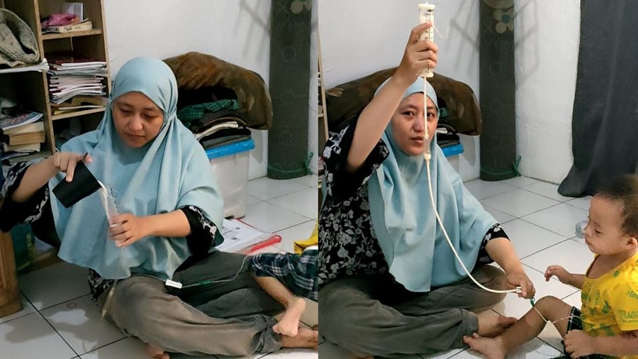 Kondisi Kritis. Bantu Kalief, Balita Yatim Agar Bisa Bertahan Hidup