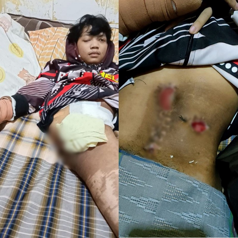 Bantu Teman Indonesia