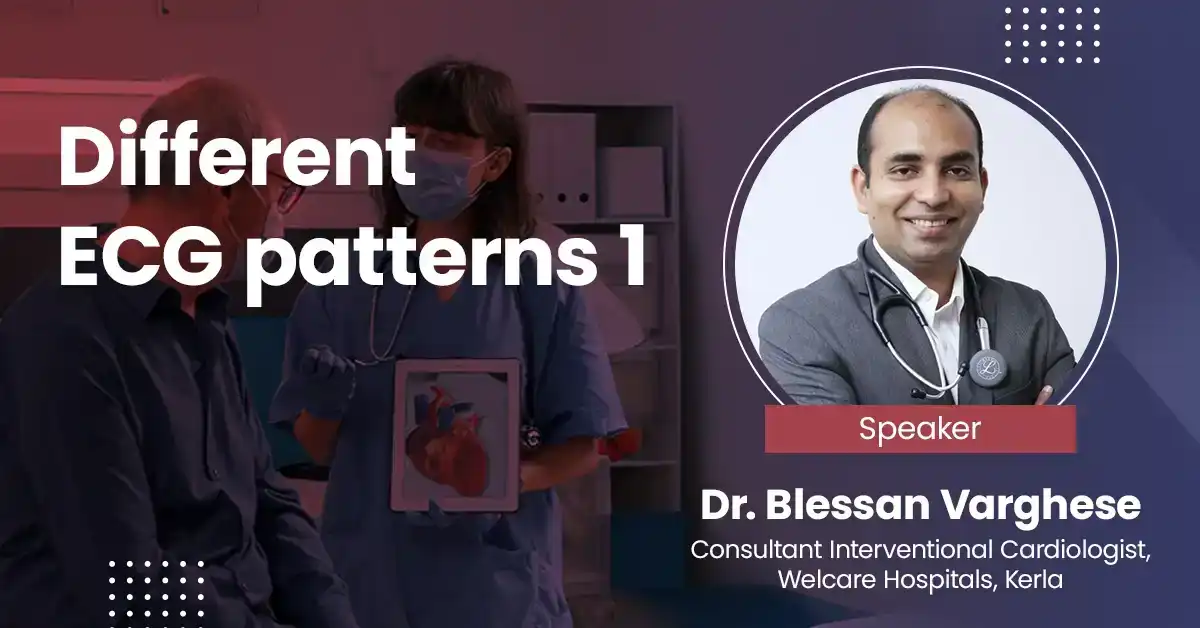 Different ECG patterns 1