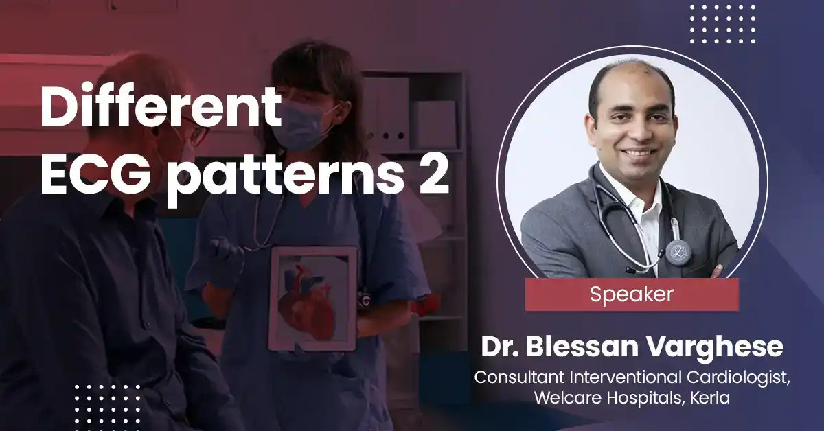 Different ECG patterns 2