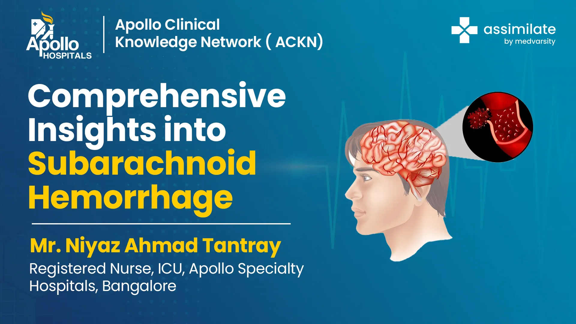 Insights into Subarachnoid Hemorrhage