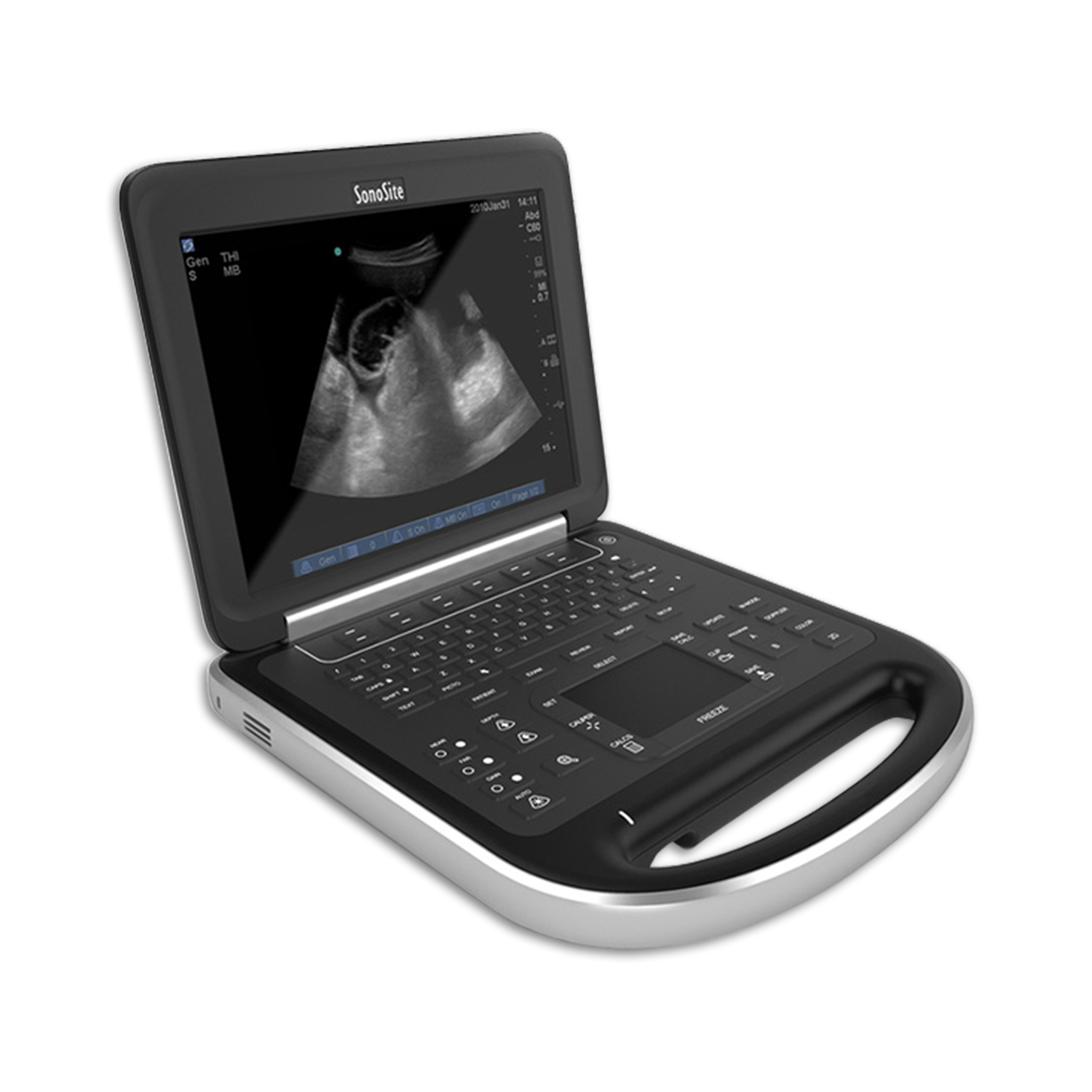 Sonosite Edge Ultrasound System