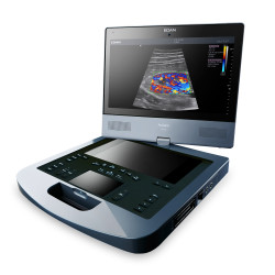 UltrasonidoportátilEdan Acclarix AX8