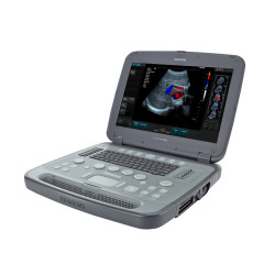 Siemens Acuson P500 Ultrasound Machine