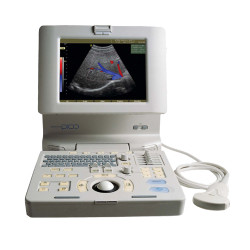 Medison's SonoAce Pico Portable Ultrasound Machine