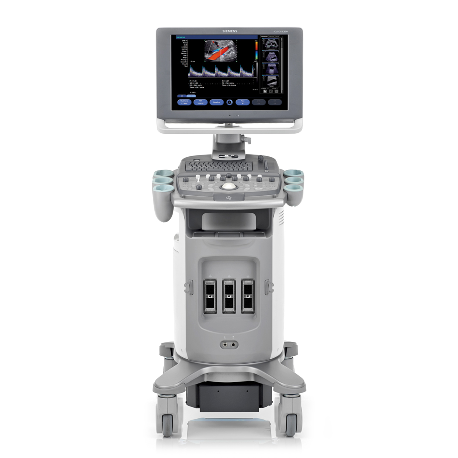 Acuson X300 PE Ultrasound System