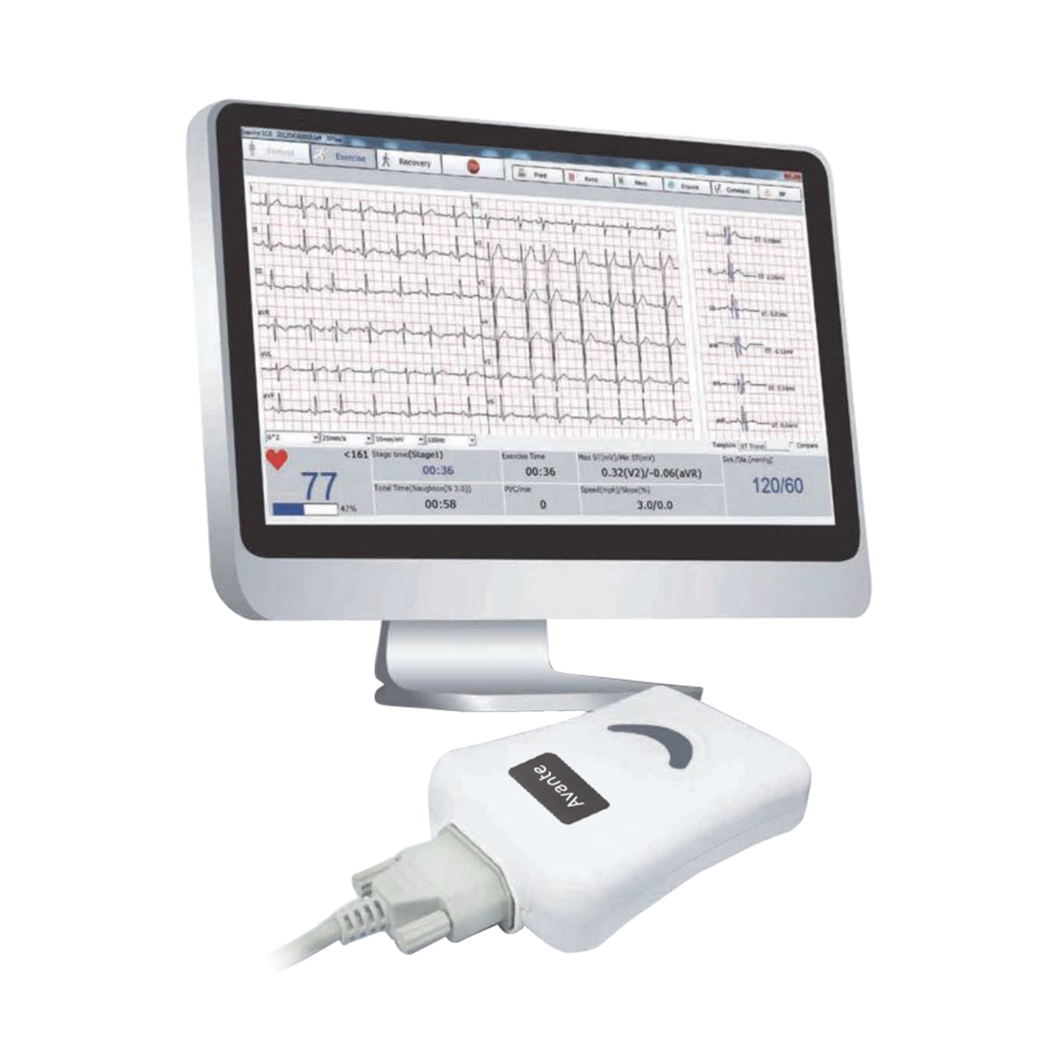 Avante Velocity EKG 12-channel PC-based EKG