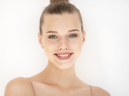 acne scars laser treatment Andover MA 01810