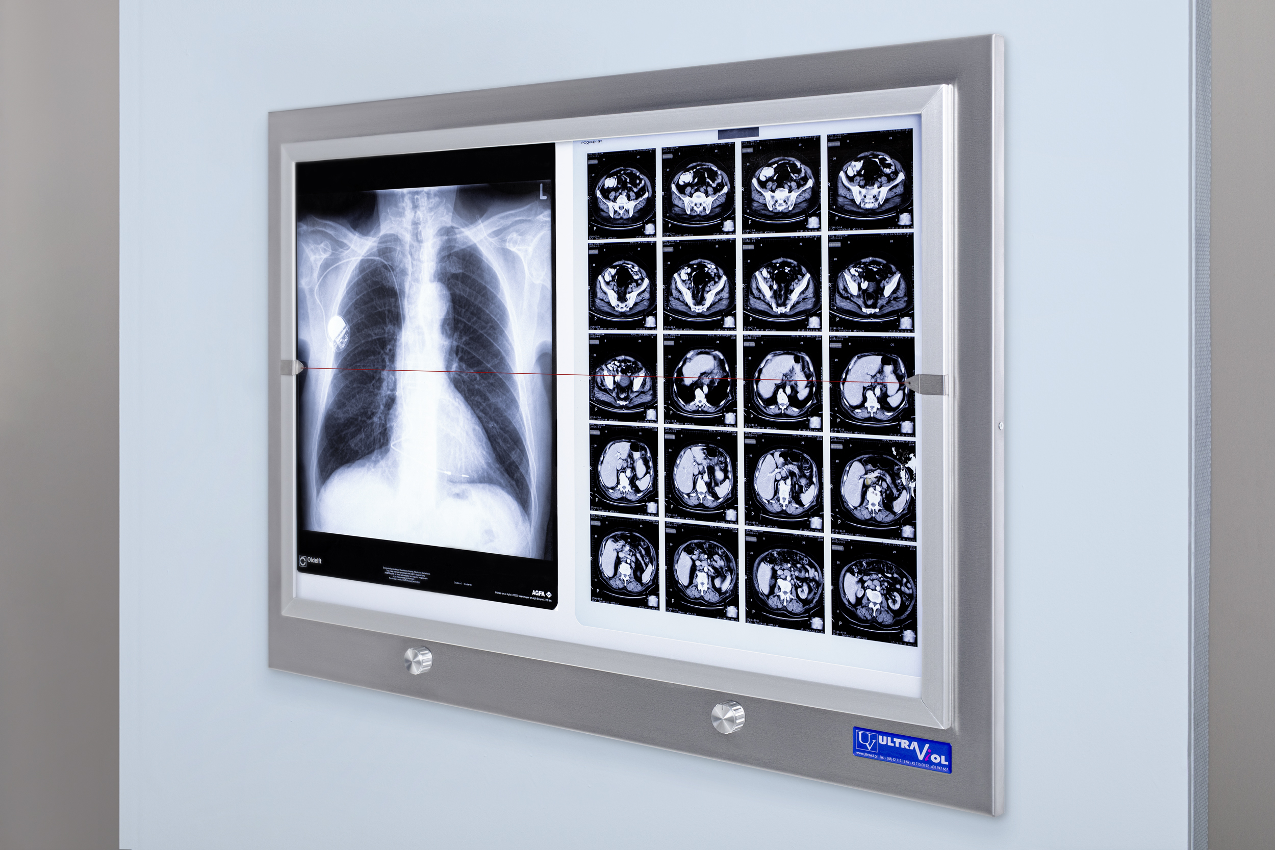 LED-NGP-21 WS X-ray film viewer (recessed version)