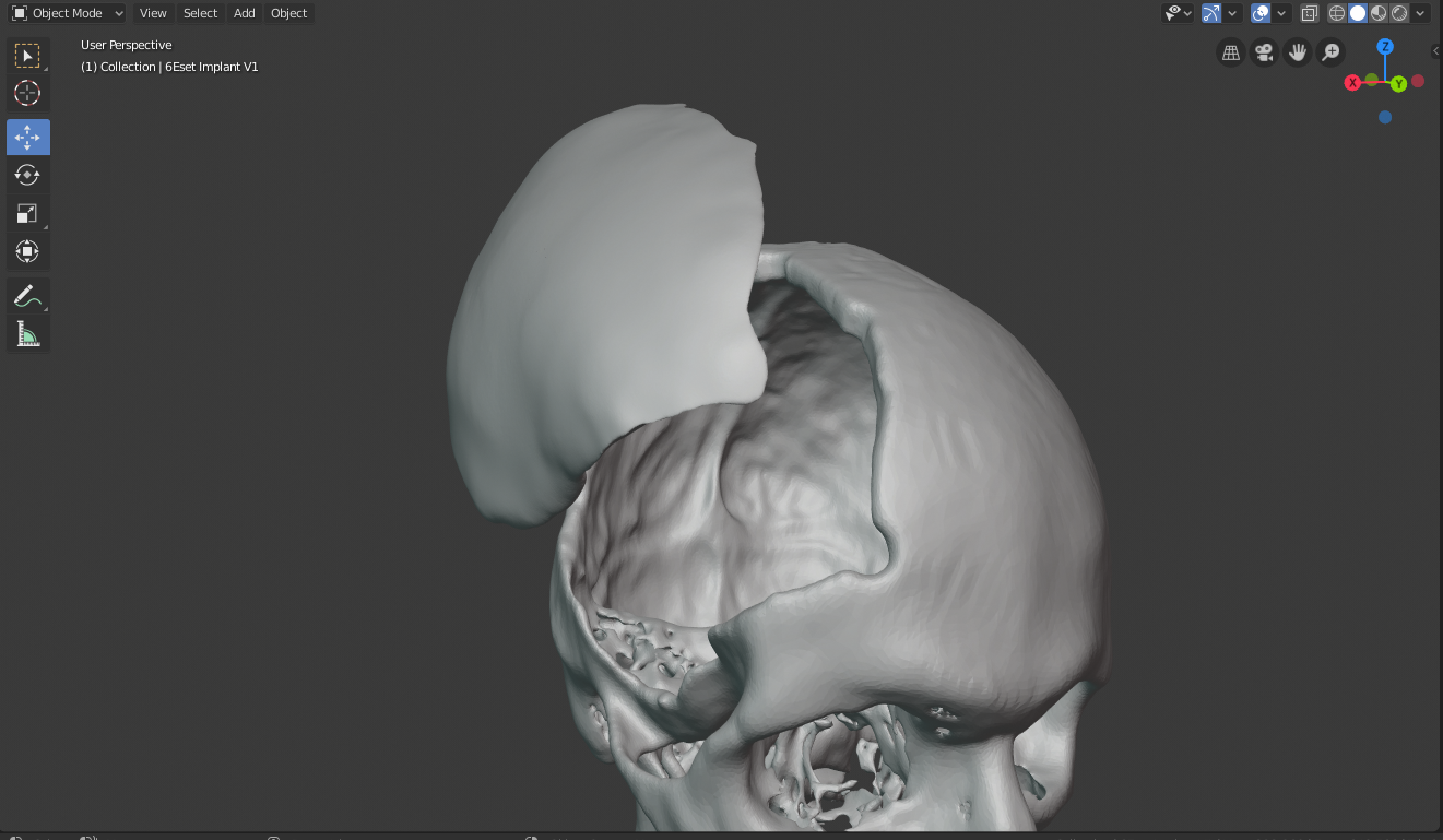 Pre-operative Planning