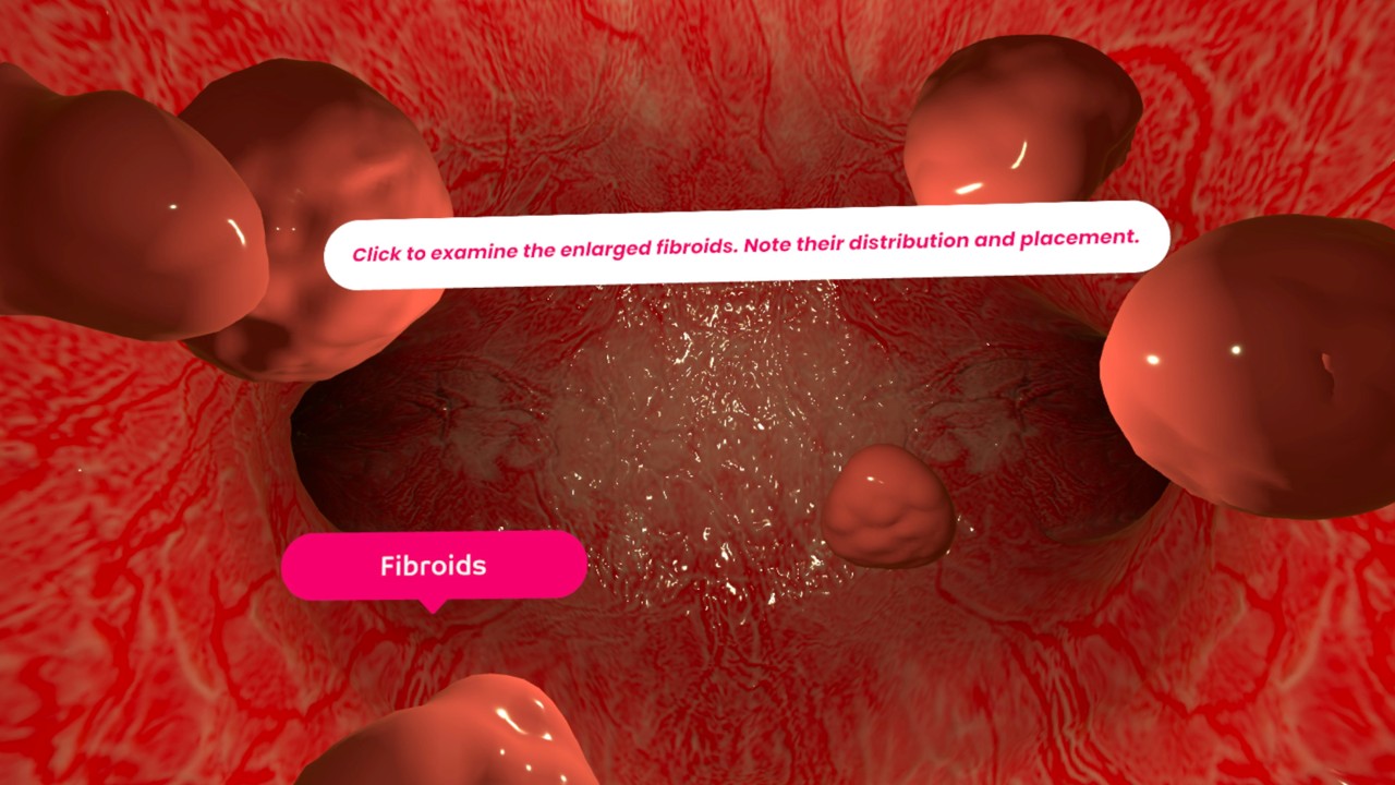 3D Uterus (inside)