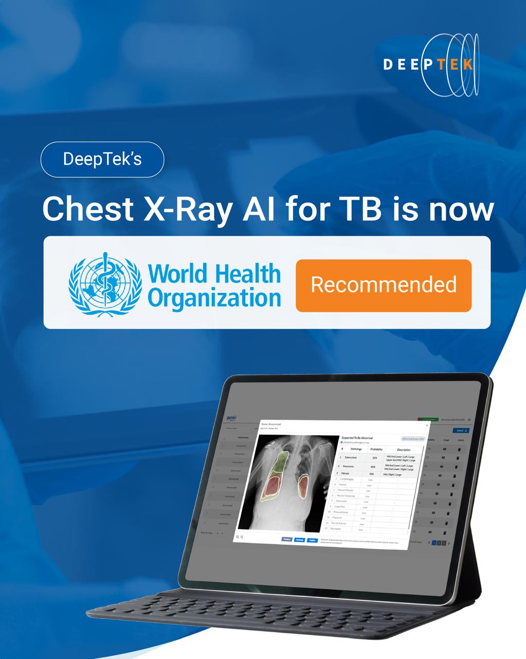 CXR Analysers