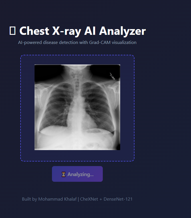 Chest X ray Interference