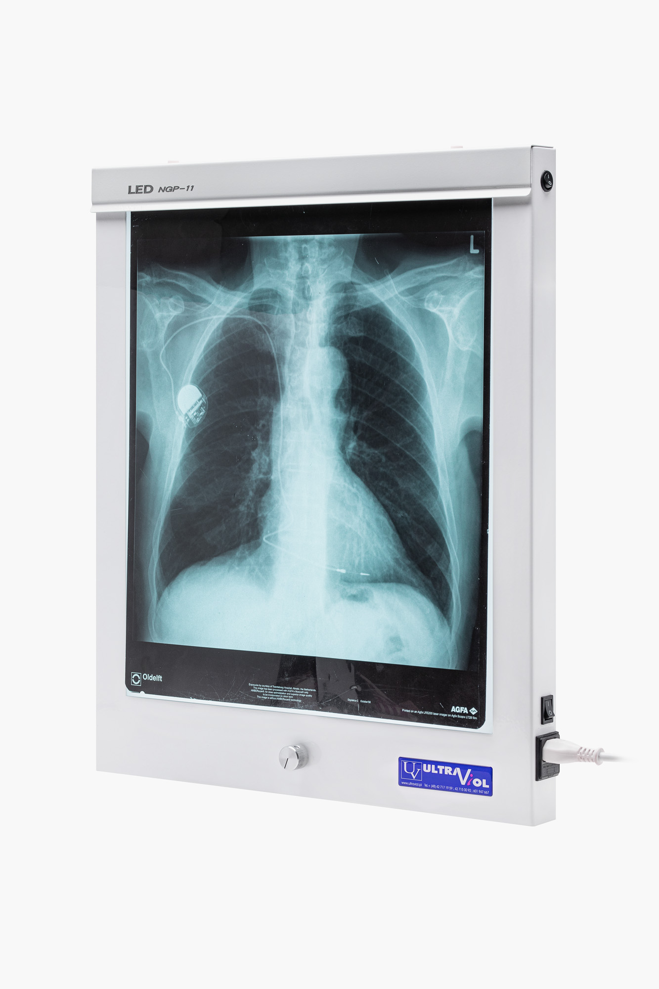 LED-NGP-11 X-ray film viewer (wall-mounted version)