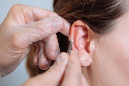 Acupuncture thumbnail - a woman's ear is treated with acupuncture, two hands with plastic gloves hold tools
