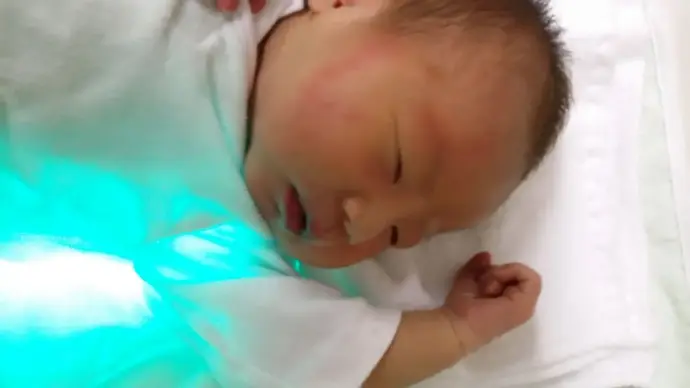体験記 新生児黄疸って 光線療法をした娘の生後12日間の記録と母のキモチ