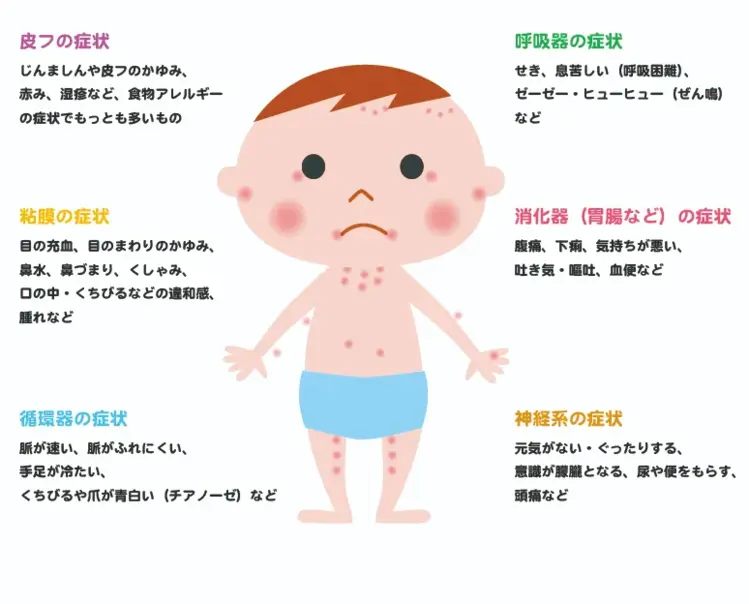 赤ちゃんから幼児の食物アレルギー 症状や病院に行く目安は どんな病院に行けばいい