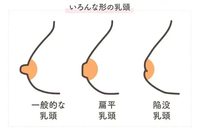 陥没乳頭や扁平乳頭とは