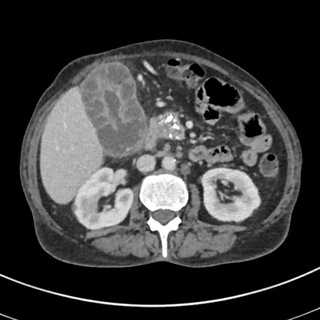 Radiology short cases — @shortradiology