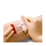 Fixador para cateter estéril BSN