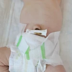 CLAMP UMBILICAL UTILIZAÇÃO