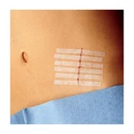 SUTURA CUTÂNEA ADESIVA STERI-STRIP 1,2X10CM R1547 6UN 3M