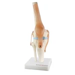 ARTICULAÇÃO DE JOELHO TGD 0164C ANATOMIC