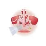 ADAPTADOR PARA LAVAGEM NASAL HIGIENIZADOR NASAL IMAGEM UTILIZANDO