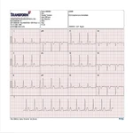 
                                        ELETROCARDIÓGRAFO ECG 12S PC ECAFIX