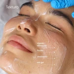 Smart kit peeling