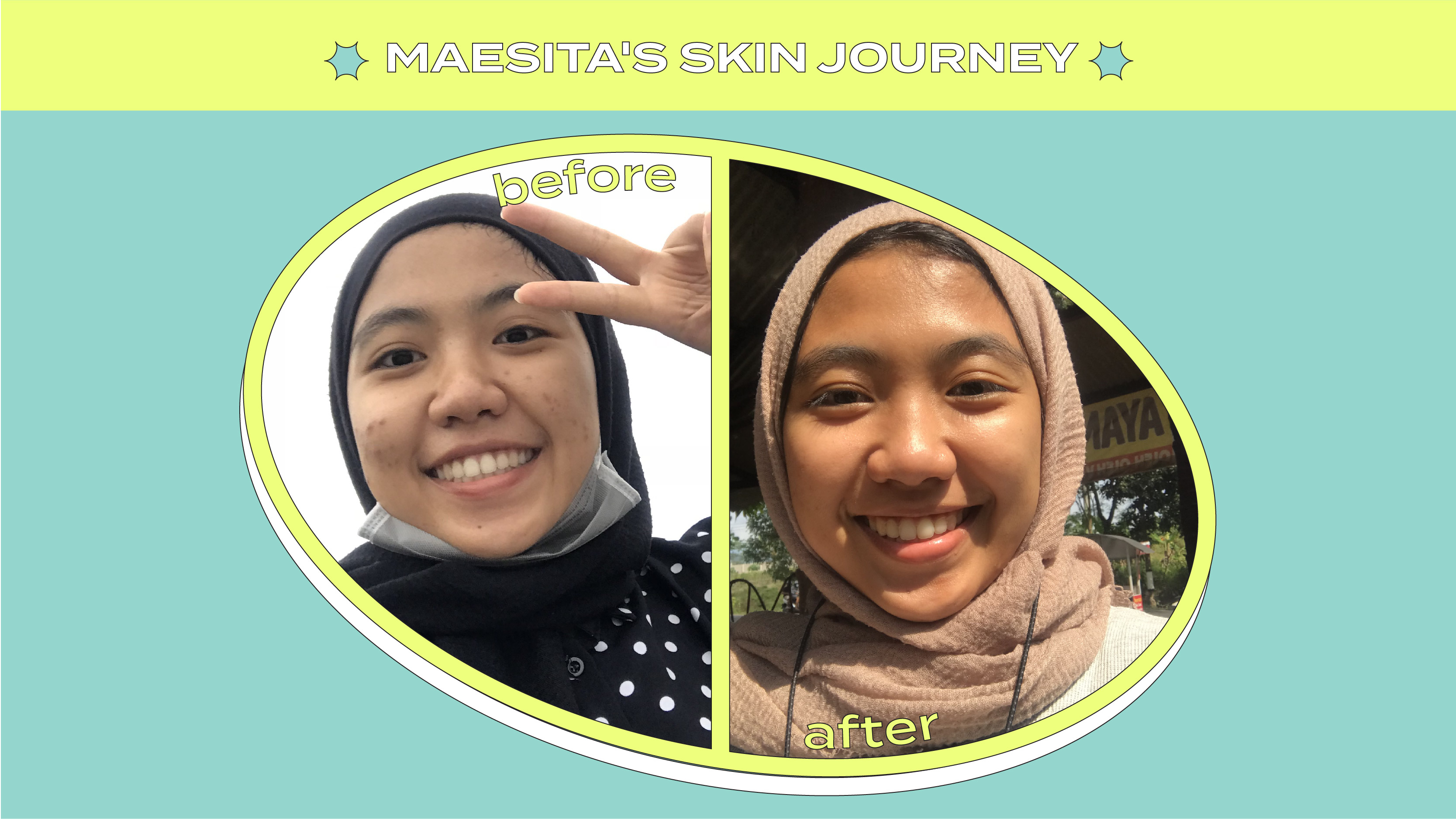 Mae's Skin Journey: Rangkaian BASE Skincare yang Ampuh Mengatasi Jerawat