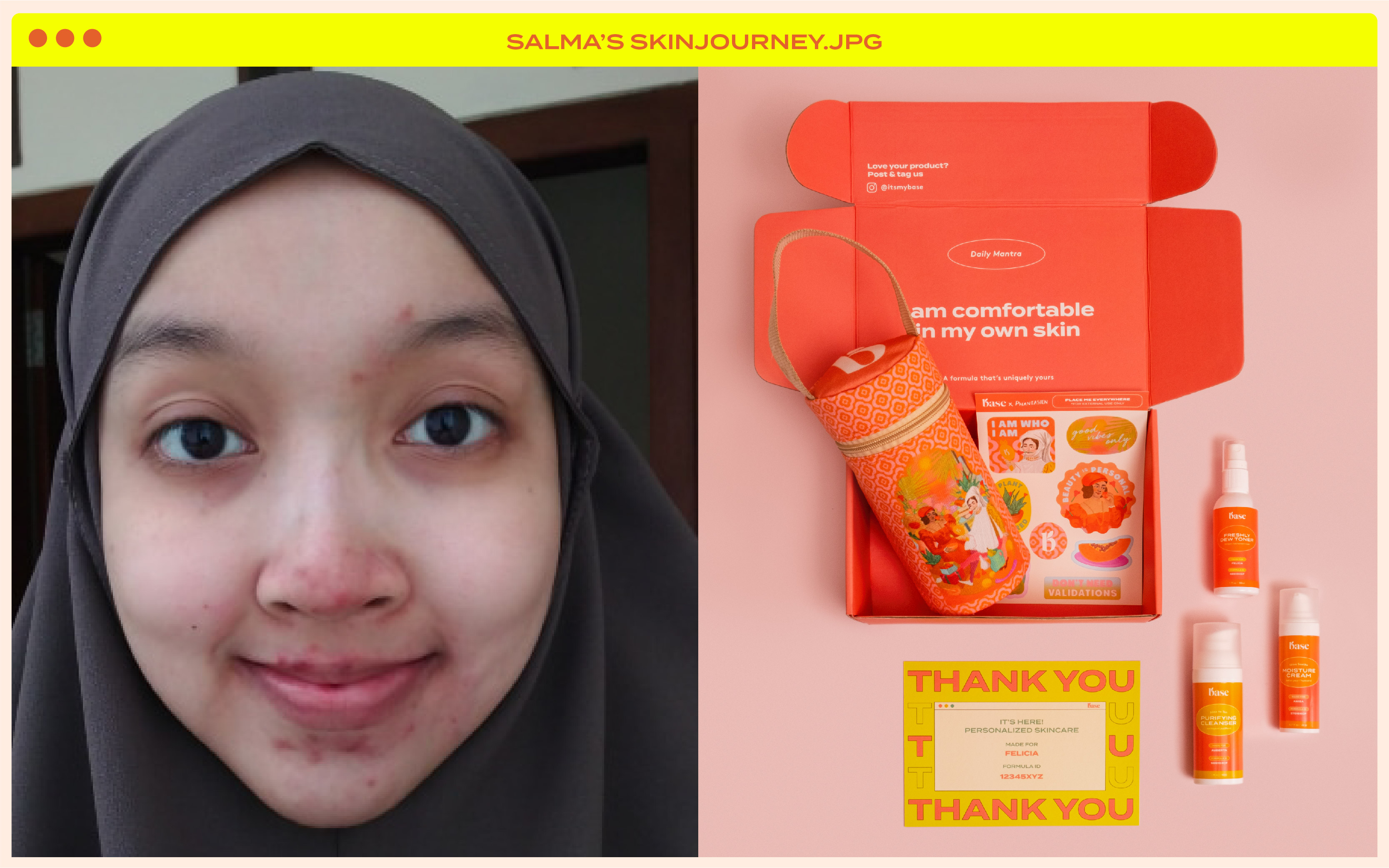 Salma’s Skin Journey: Sering Gonta-ganti Skincare Sampai Akhirnya Menemukan BASE