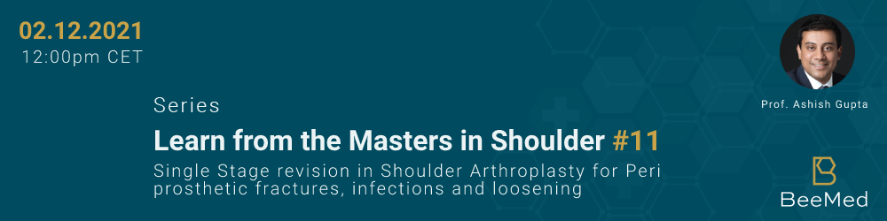 Single Stage revision in Shoulder Arthroplasty for Peri prosthetic fractures, infections and loosening