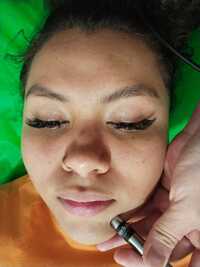 Facial Premium: Laser + Higiene Profunda 
