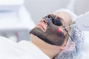 HOLLYWOOD PEEL