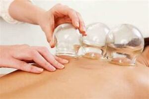 CUPPING 