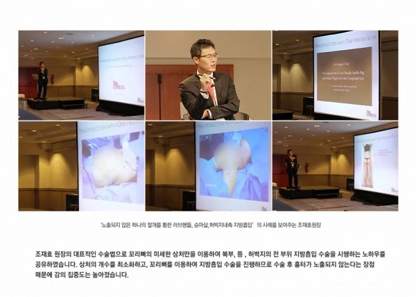 2014 제22회 지중해 미용성형의학 학술대회 - 10 - 더라인성형외과