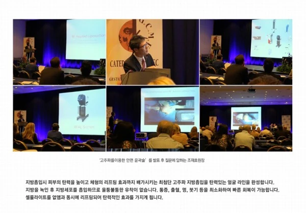 2014 제22회 지중해 미용성형의학 학술대회 - 15 - 더라인성형외과