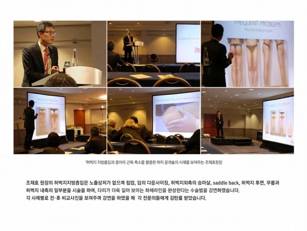 2014 제22회 지중해 미용성형의학 학술대회 - 7 - 더라인성형외과