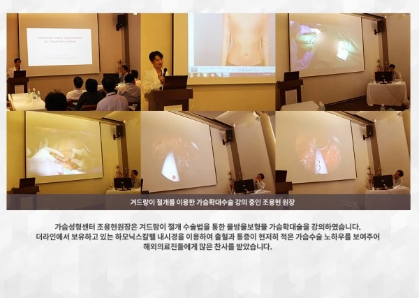 [라이브수술 워크샵] 세계 각국 30여명의 해외의료진들을 대상으로 한 라이브수술 워크샵 - 14 - 더라인성형외과